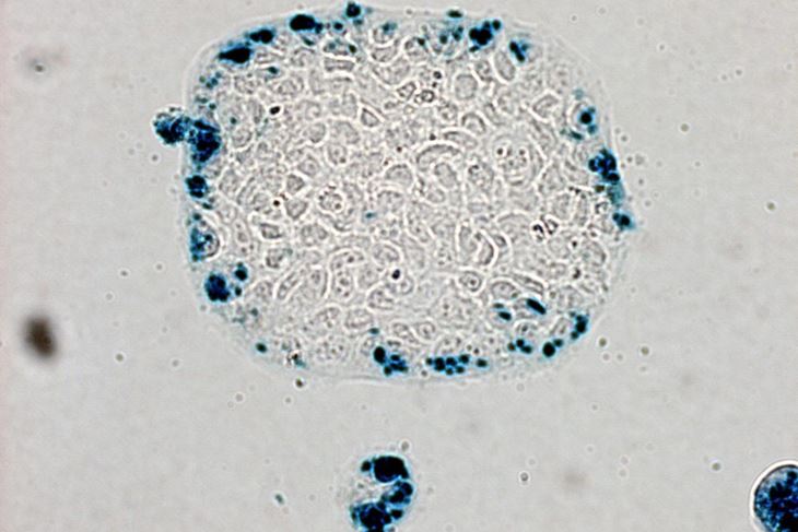 EPA