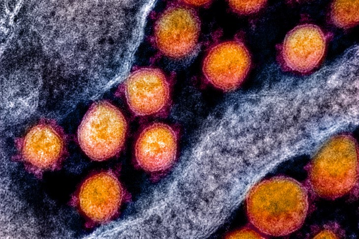 (EPA)