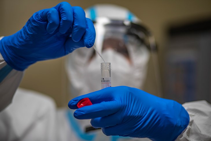 koronavirus, coronavirus, covid19, zaraza, epidemija, 
pandemija, virus, cjepivo, test, testiranje
EPA