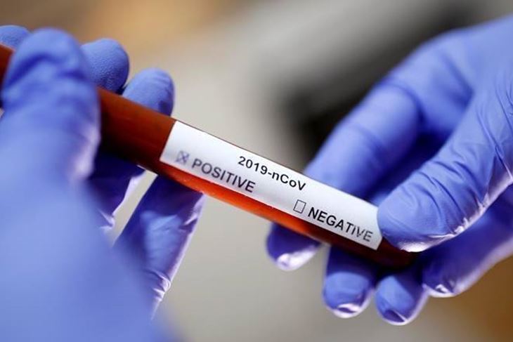 (EPA)