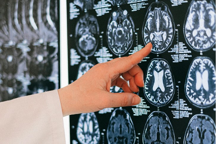 Ilustracija (Pexels)