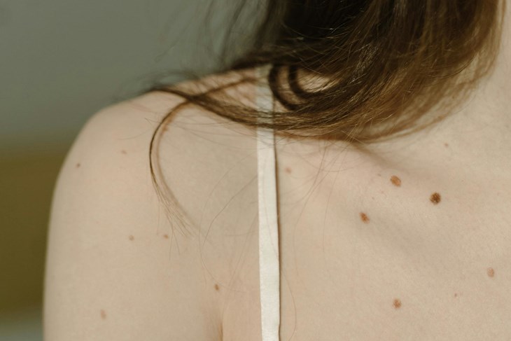 Ilustracija (Pexels)